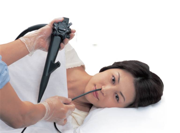 Bệnh viện ĐKTP đồng hới triển khai nội soi thực quản - dạ dày - tá tràng bằng ống mềm qua đường mũi